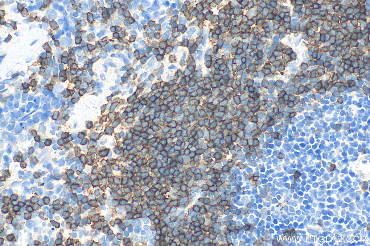 IHC staining of mouse spleen using 32183-1-AP