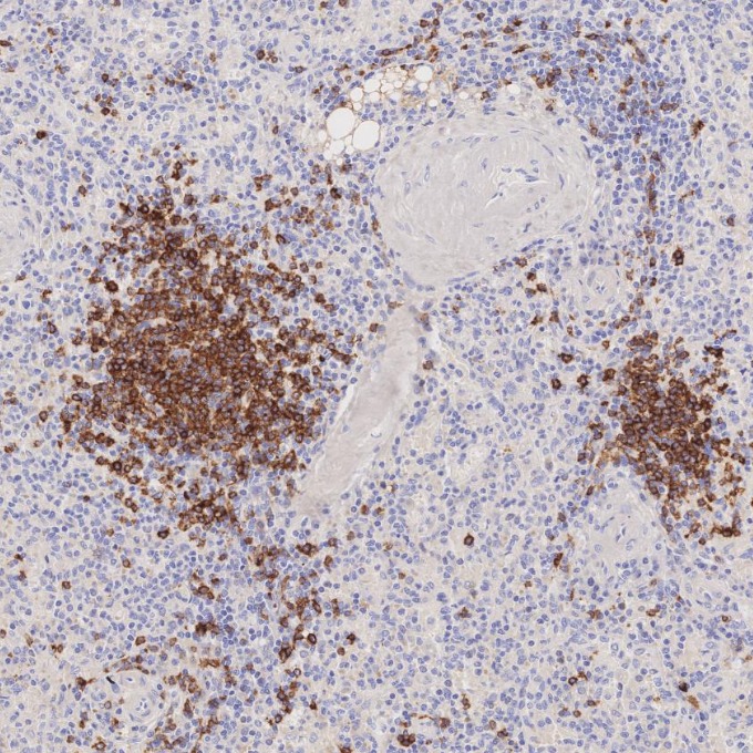 IHC staining of human spleen using 66103-1-Ig IHC staining of human spleen using 66103-1-Ig
