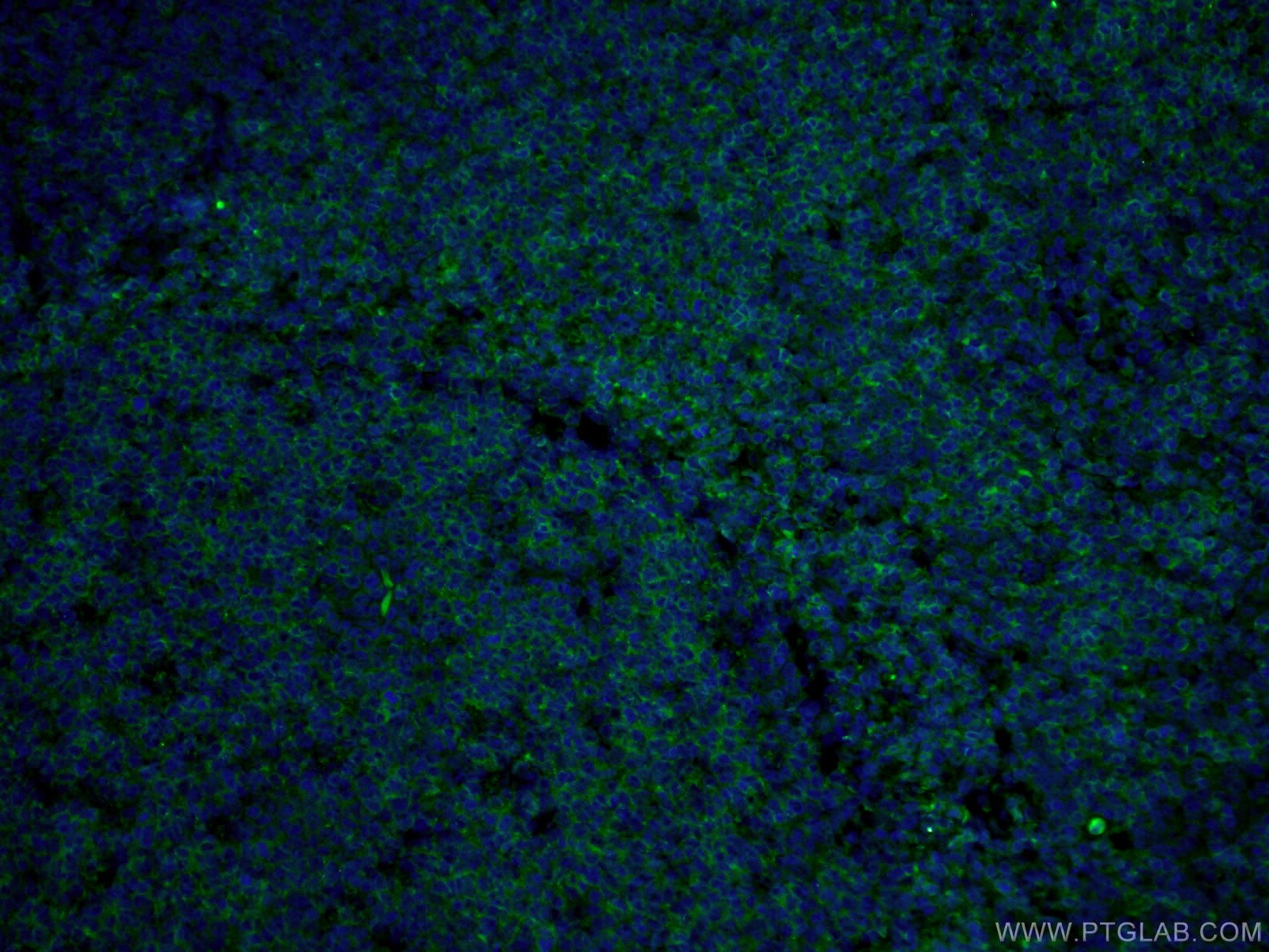 IF Staining of human tonsillitis using CL488-66103