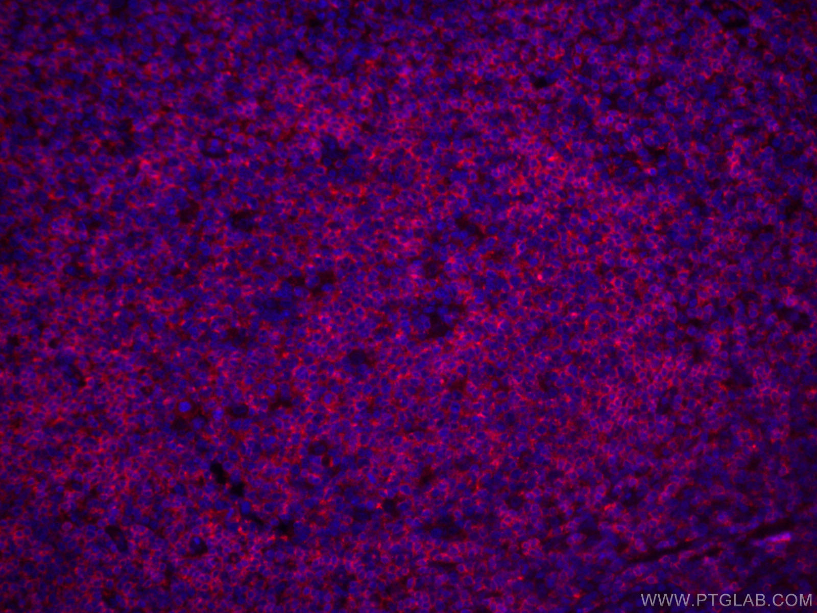 IF Staining of human tonsillitis using CL594-66103