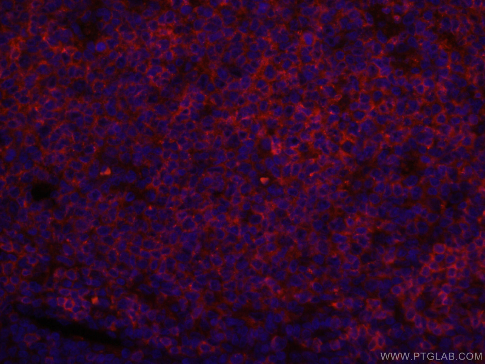 IF Staining of human tonsillitis using CL594-66103