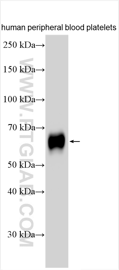 WB analysis of human peripheral blood platelets using 30727-1-AP