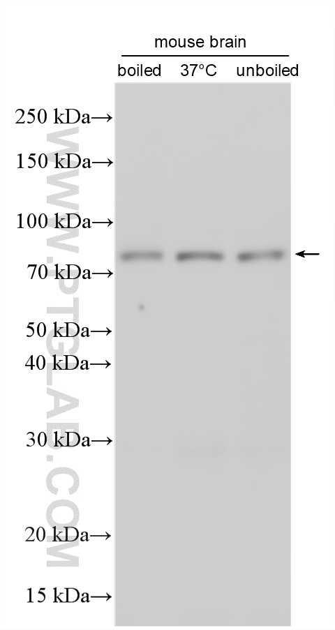 WB analysis using 33666-1-AP