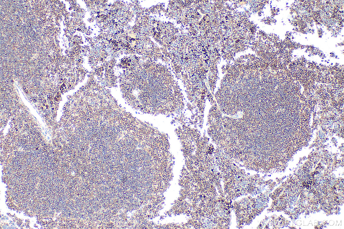 IHC staining of mouse spleen using 32666-1-AP