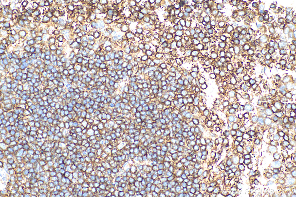 IHC staining of mouse spleen using 32666-1-AP