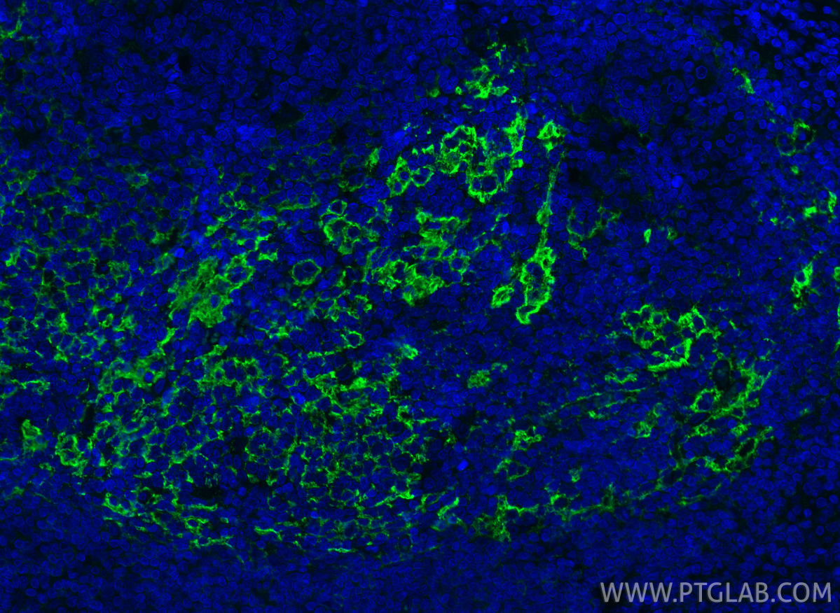 IF Staining of human tonsillitis using 60208-1-Ig