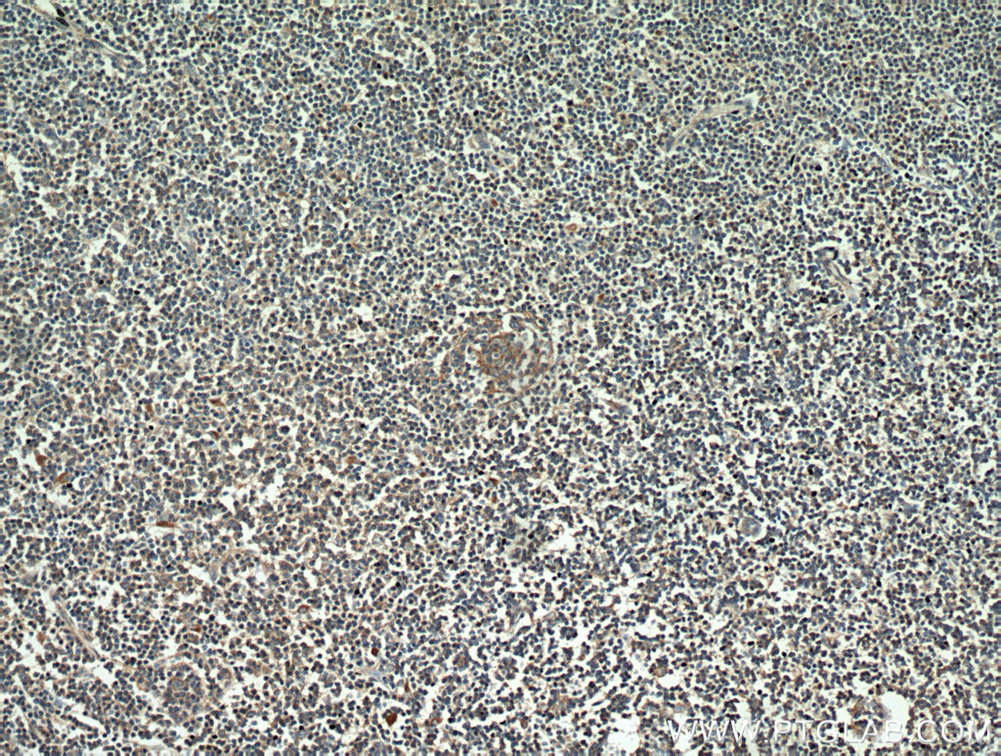 CD23