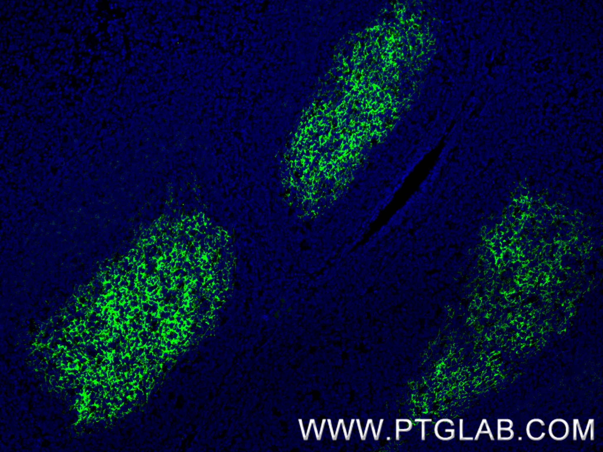 IF Staining of human tonsil using 84024-2-RR IF Staining of human tonsil using 84024-2-RR