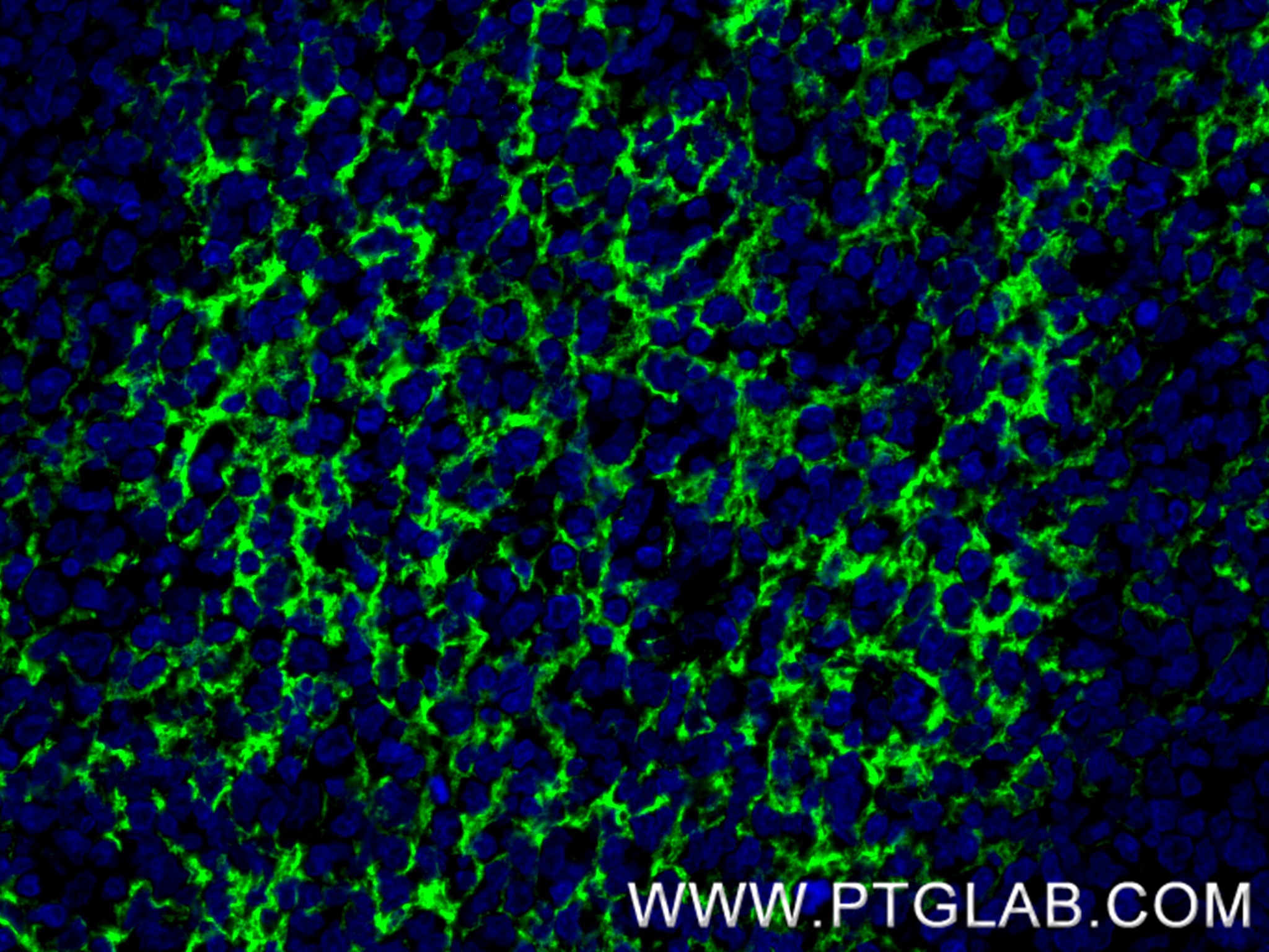 IF Staining of human tonsil using 84024-2-RR IF Staining of human tonsil using 84024-2-RR