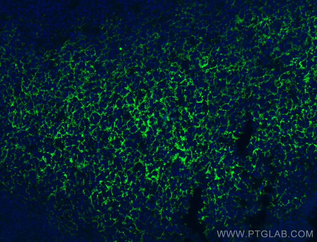 IF Staining of human tonsillitis using CL488-60208-2