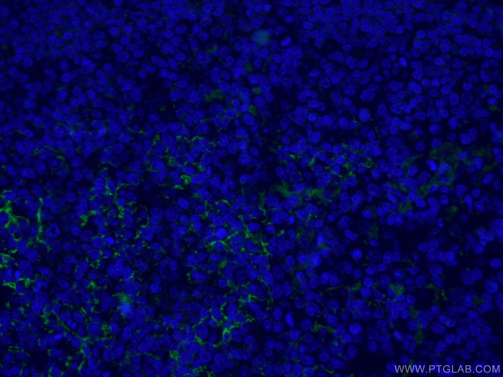 IF Staining of human tonsillitis using CL488-60208