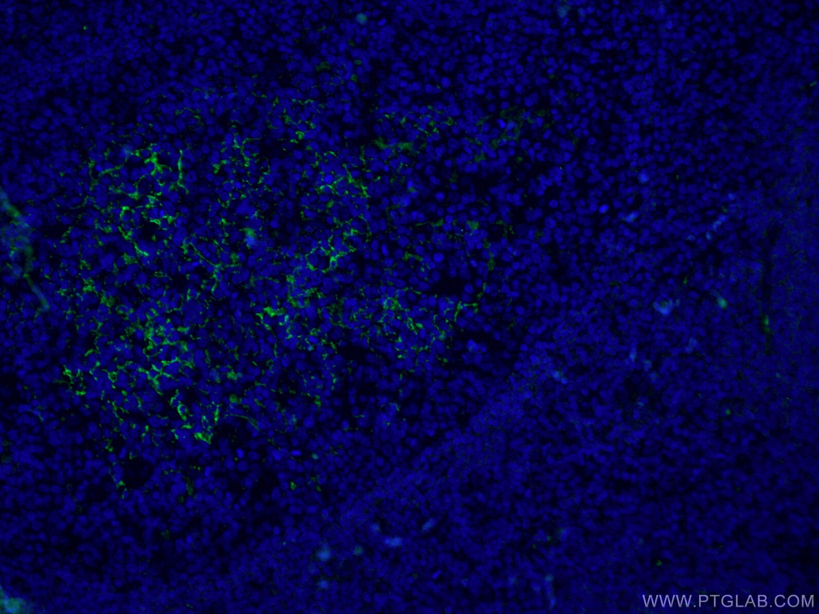 IF Staining of human tonsillitis using CL488-60208