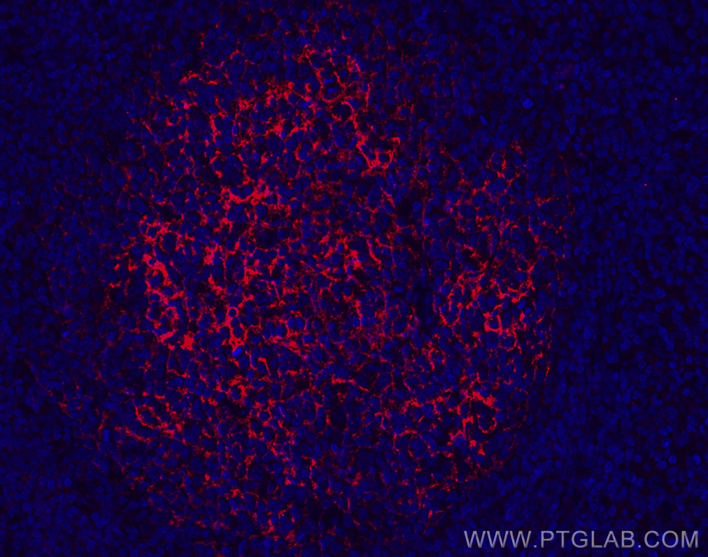 IF Staining of human tonsillitis using CL594-60208-2