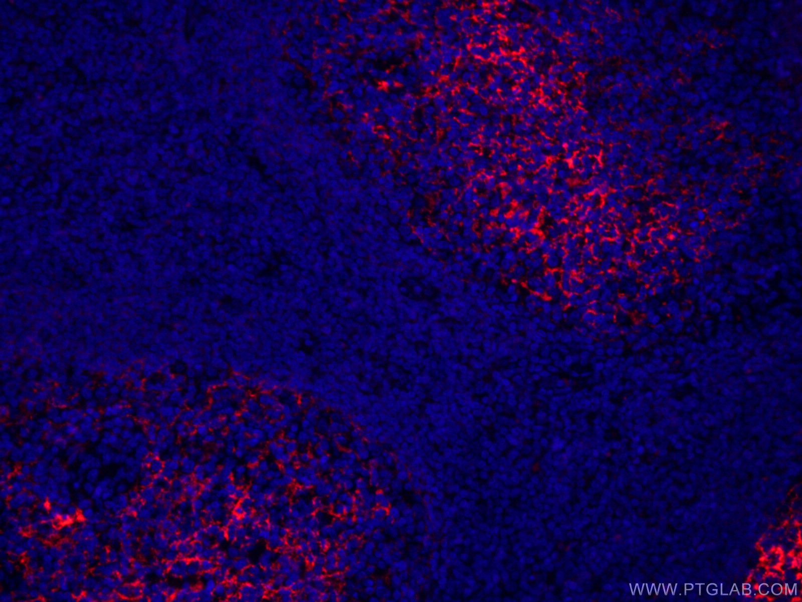 IF Staining of human tonsillitis using CL594-60208