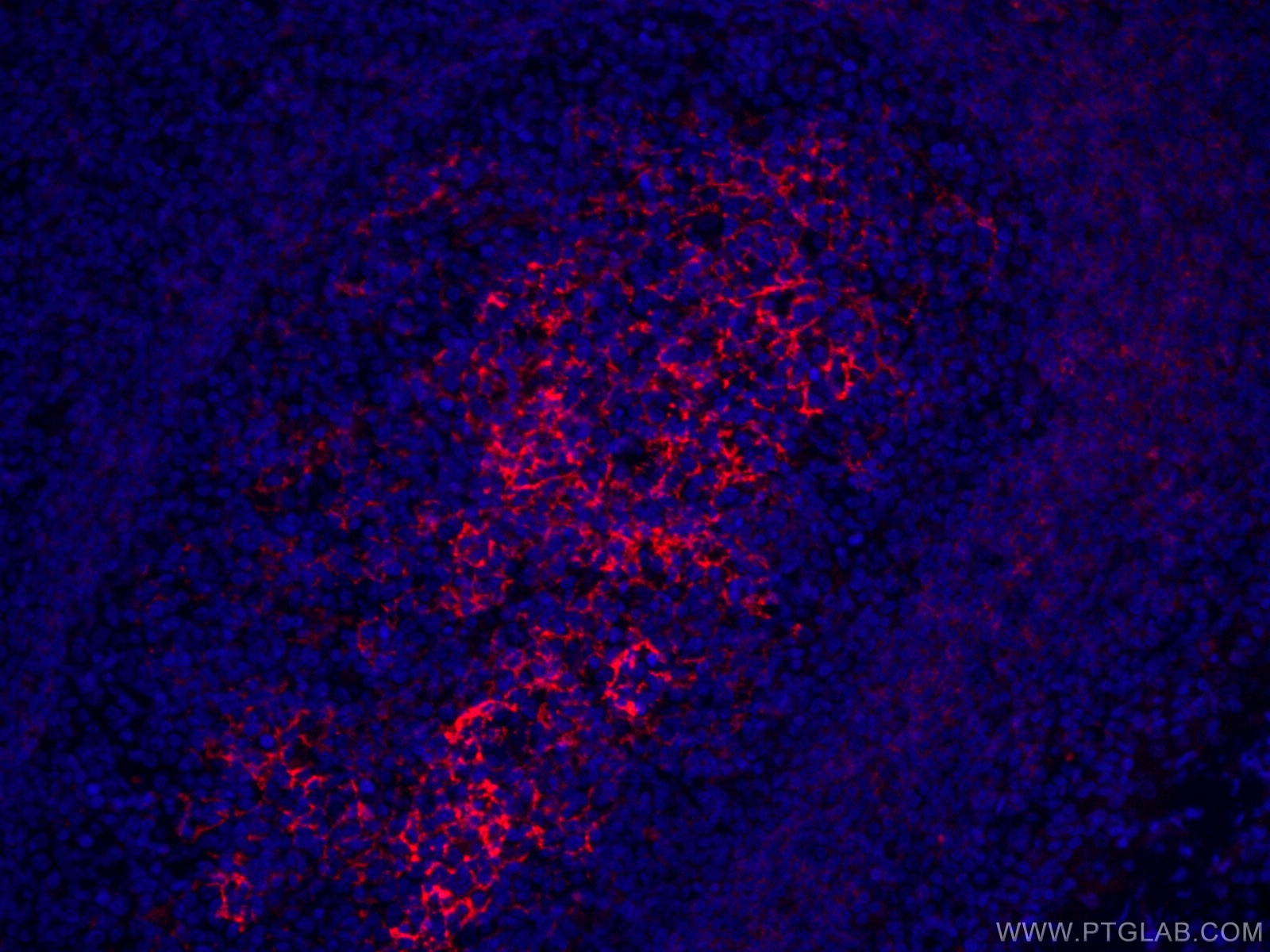 IF Staining of human tonsillitis using CL594-60208