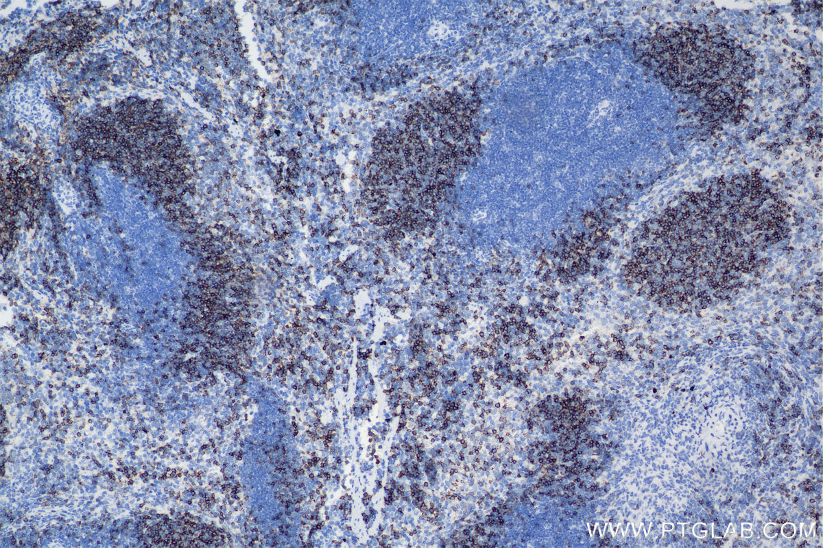 IHC staining of mouse spleen using 84212-3-RR