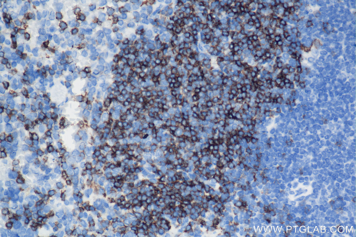 IHC staining of mouse spleen using 84212-3-RR