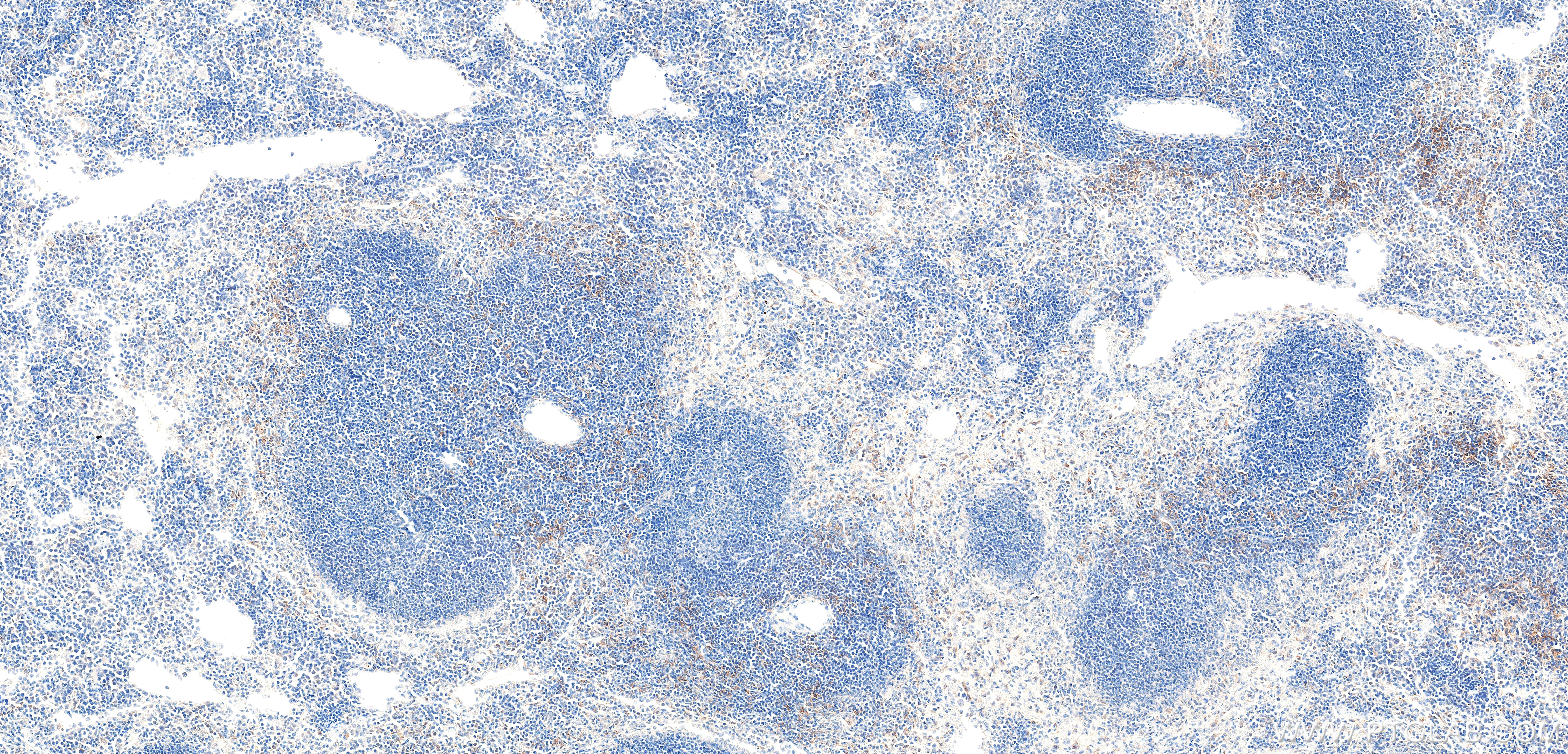 IHC staining of mouse spleen using 87759-2-RR