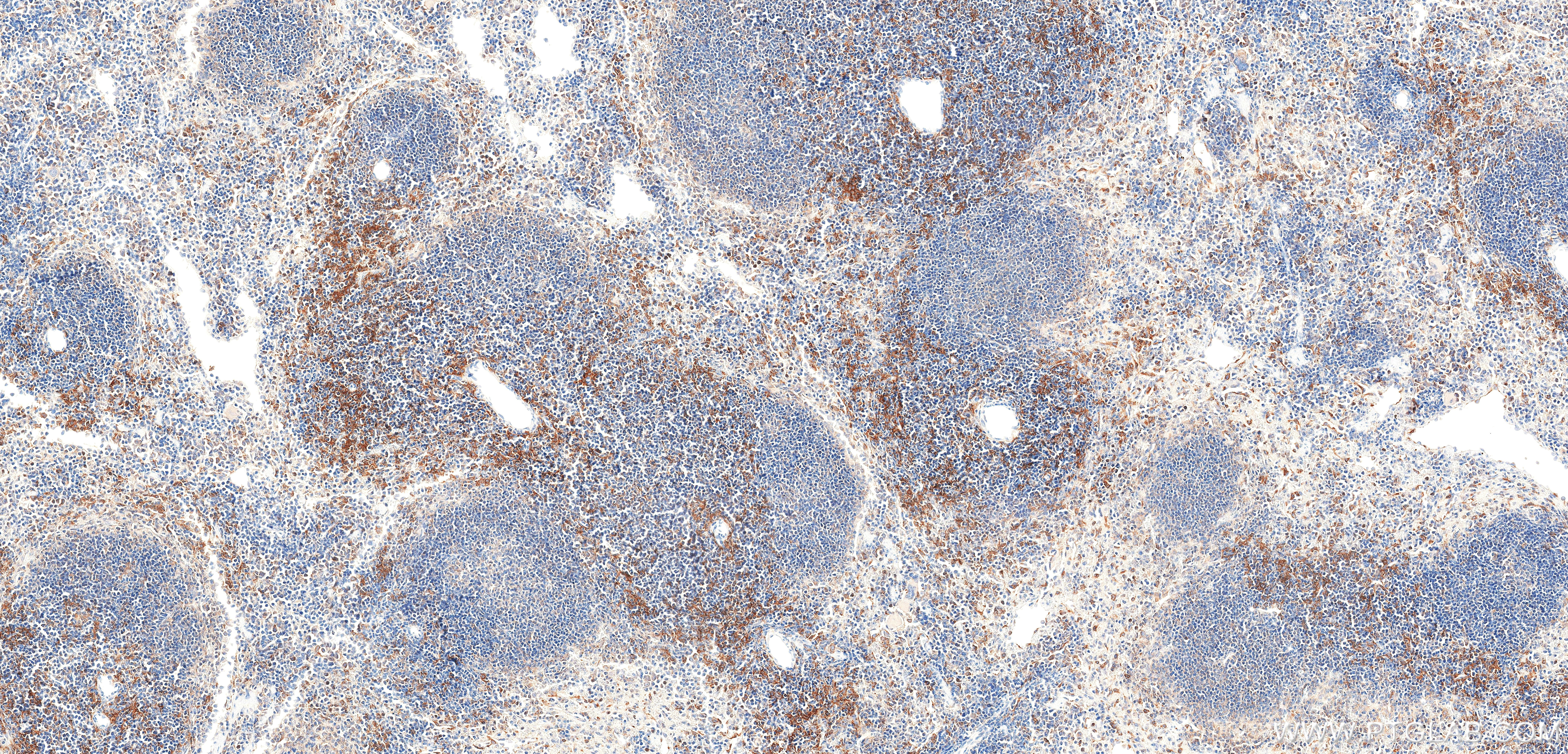 IHC staining of mouse spleen using 87759-3-RR