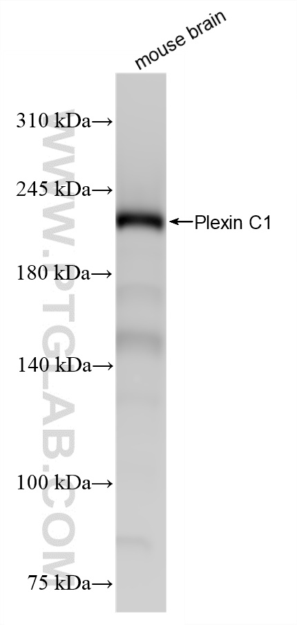 WB analysis of mouse brain using 87759-3-RR