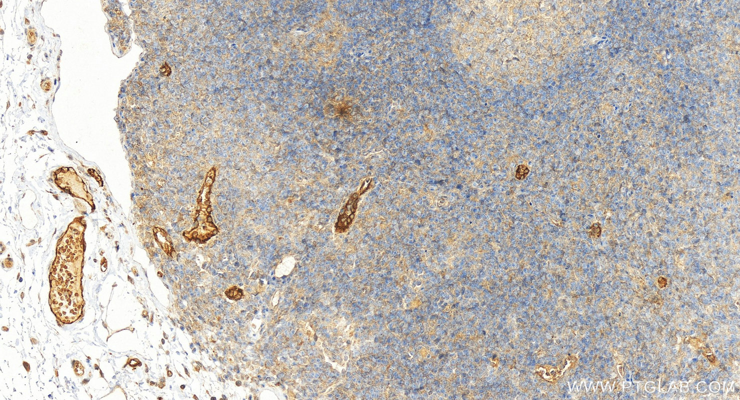 Immunohistochemical analysis of paraffin-embedded human colon tissue slide using 55185-1-AP (DARC antibody) at dilution of 1:200 (under 20x lens). Heat mediated antigen retrieval with Tris-EDTA buffer (pH 9.0). IHC staining of human colon using 55185-1-AP