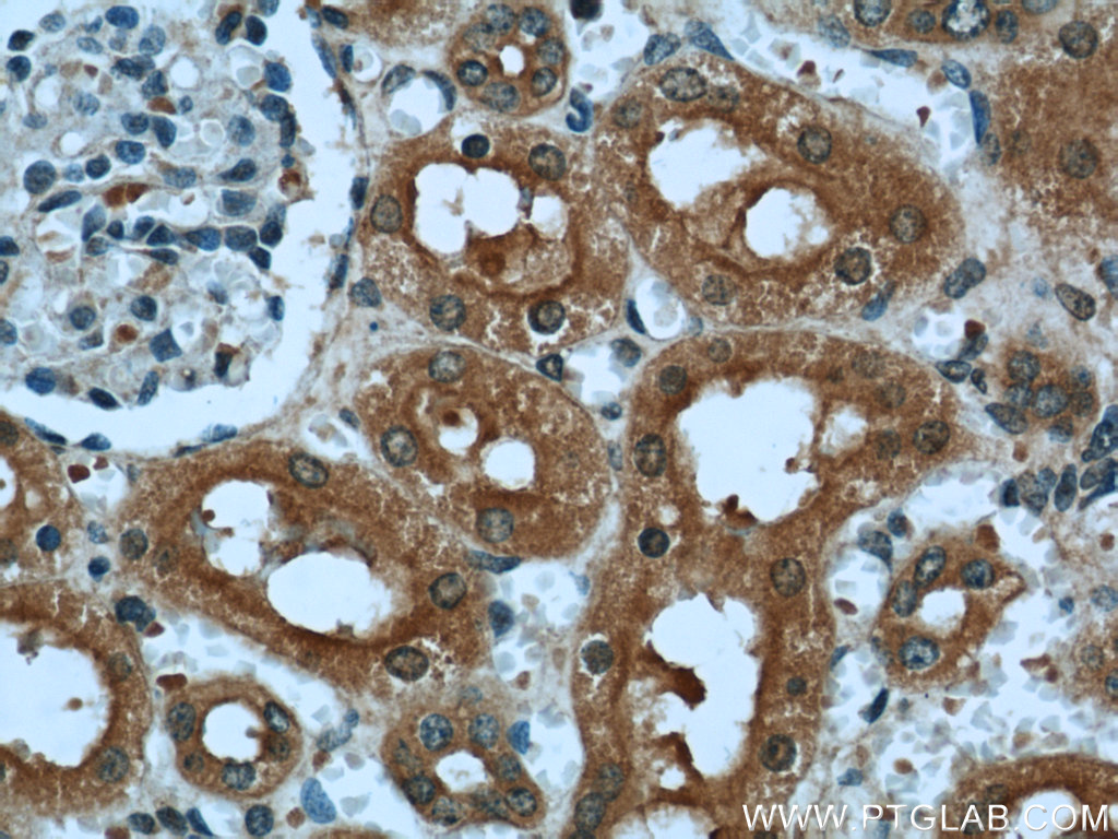 IHC staining of human kidney using 55185-1-AP