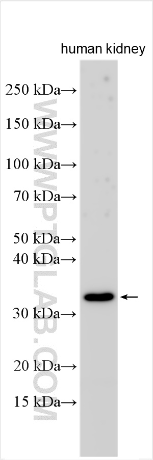 Human kidney tissue were subjected to SDS PAGE followed by western blot with 55185-1-AP (DARC antibody) at dilution of 1:500 incubated at room temperature for 1.5 hours. WB analysis using 55185-1-AP