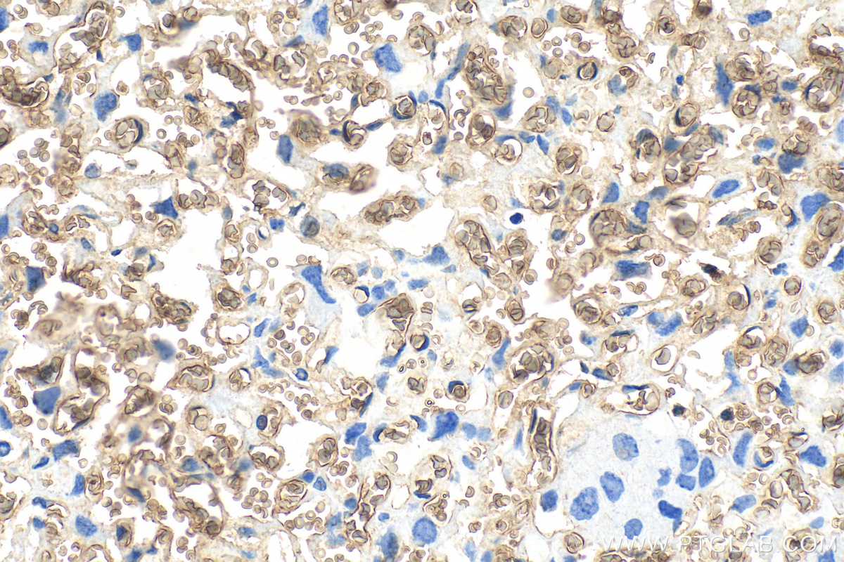 IHC staining of mouse placenta using 30864-1-AP