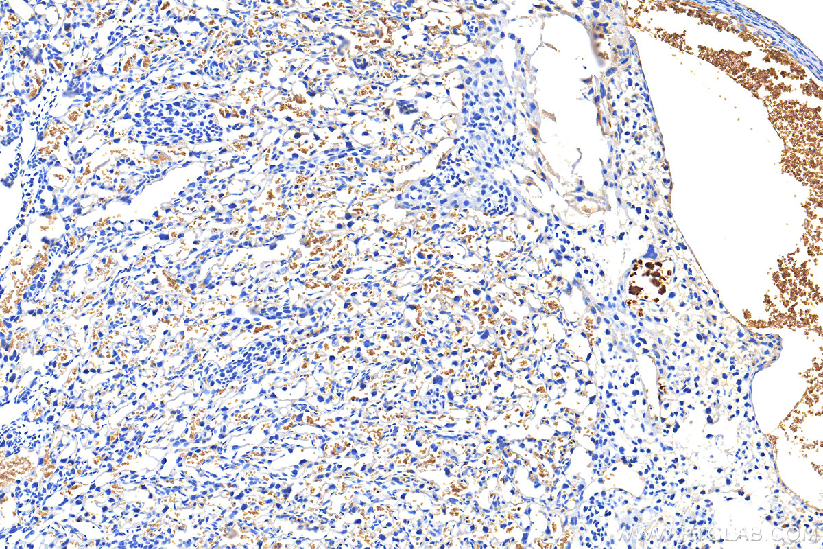 IHC staining of mouse placenta using 32339-1-AP