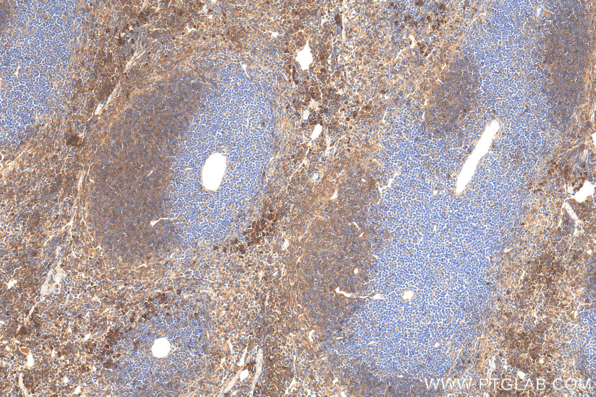 IHC staining of mouse spleen using 32150-1-AP