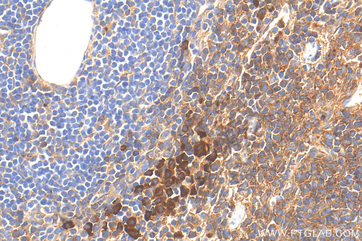 IHC staining of mouse spleen using 32150-1-AP
