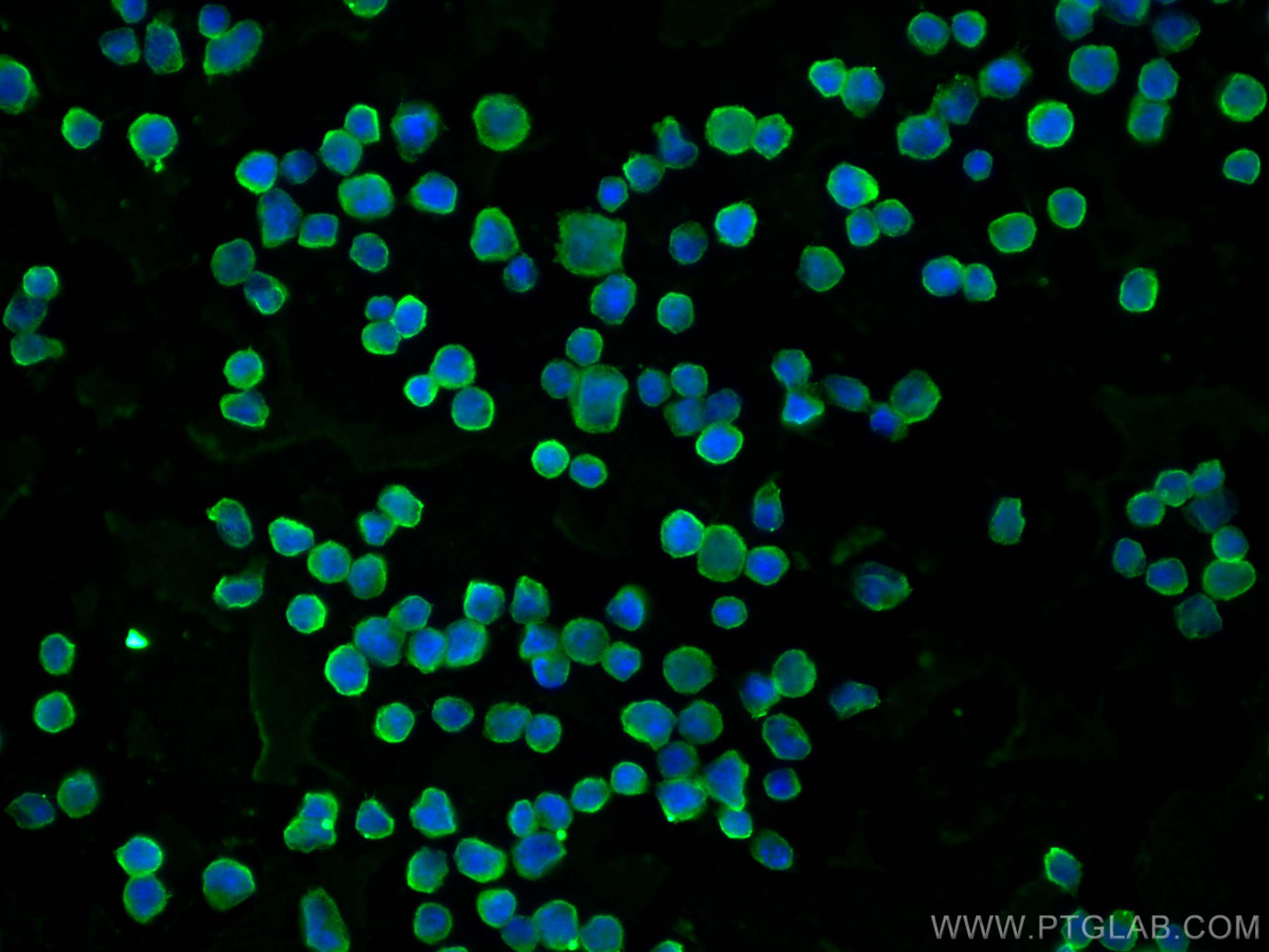 IF Staining of Daudi using 67627-1-Ig (same clone as 67627-1-PBS)