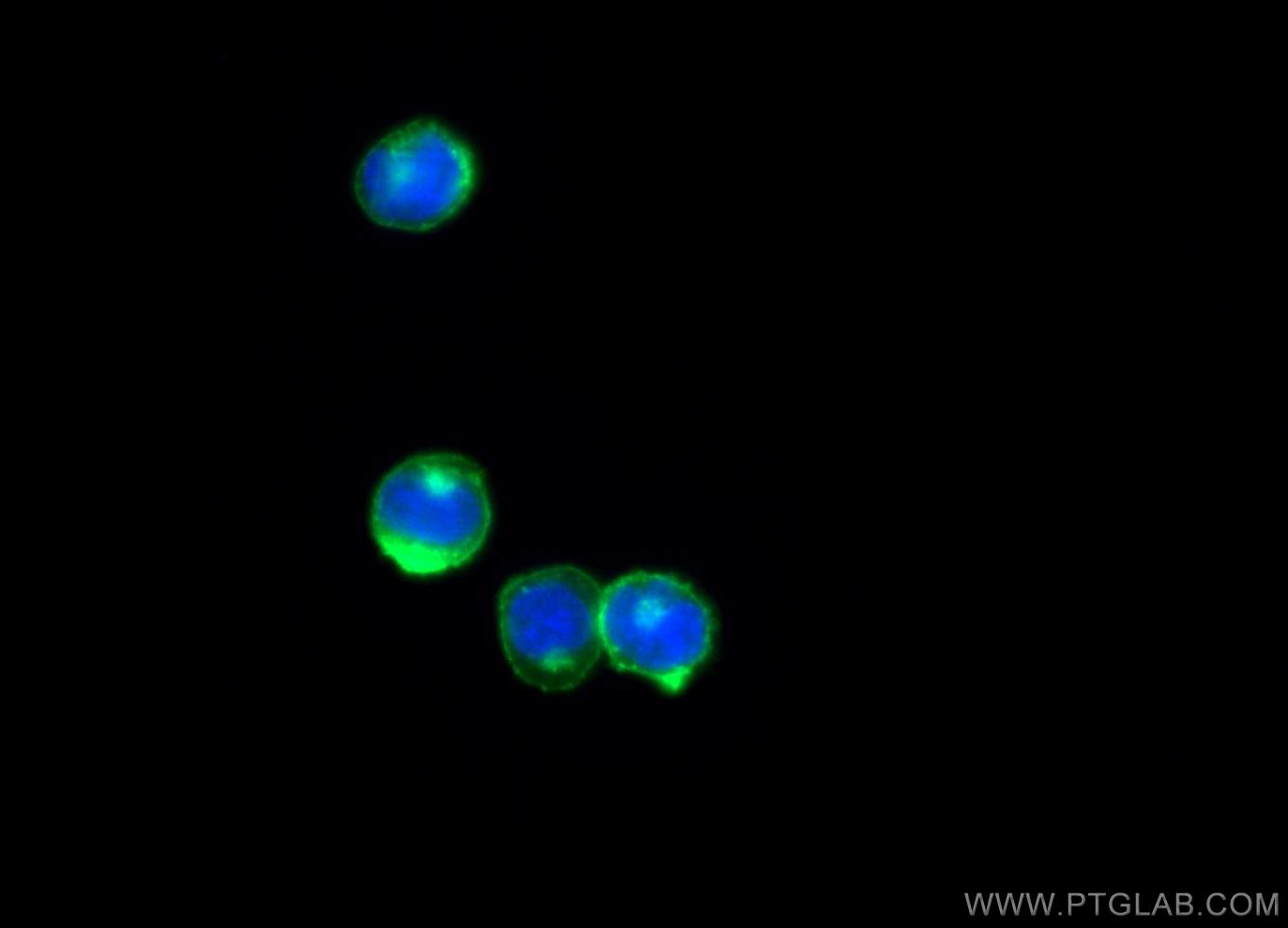 IF Staining of Jurkat using 12837-2-AP