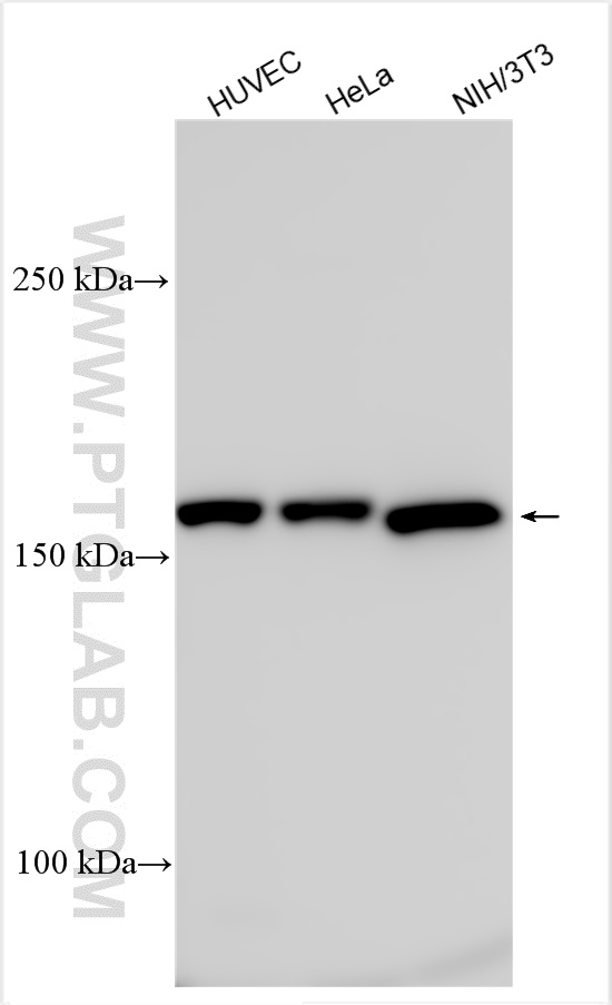 Various lysates were subjected to SDS PAGE followed by western blot with 18160-1-AP (TEM1 antibody) at dilution of 1:1000 incubated at room temperature for 1.5 hours. WB analysis using 18160-1-AP