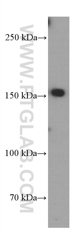 TEM1 Monoclonal antibody