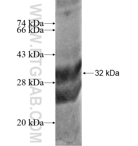 CD248 fusion protein Ag13354 SDS-PAGE CD248 fusion protein Ag13354 SDS-PAGE