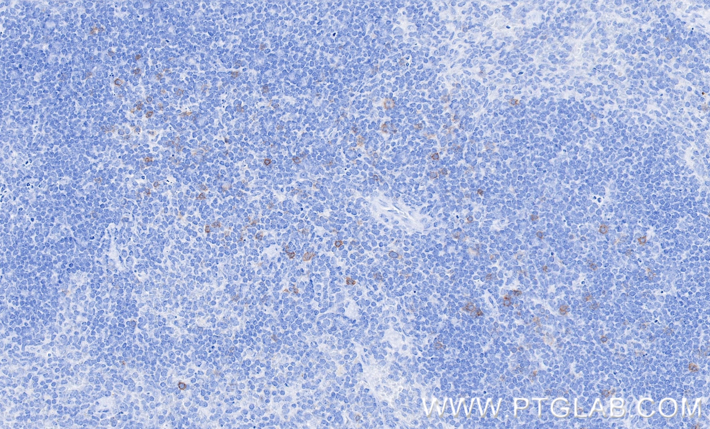 IHC staining of mouse spleen using 98288-1-RR IHC staining of mouse spleen using 98288-1-RR