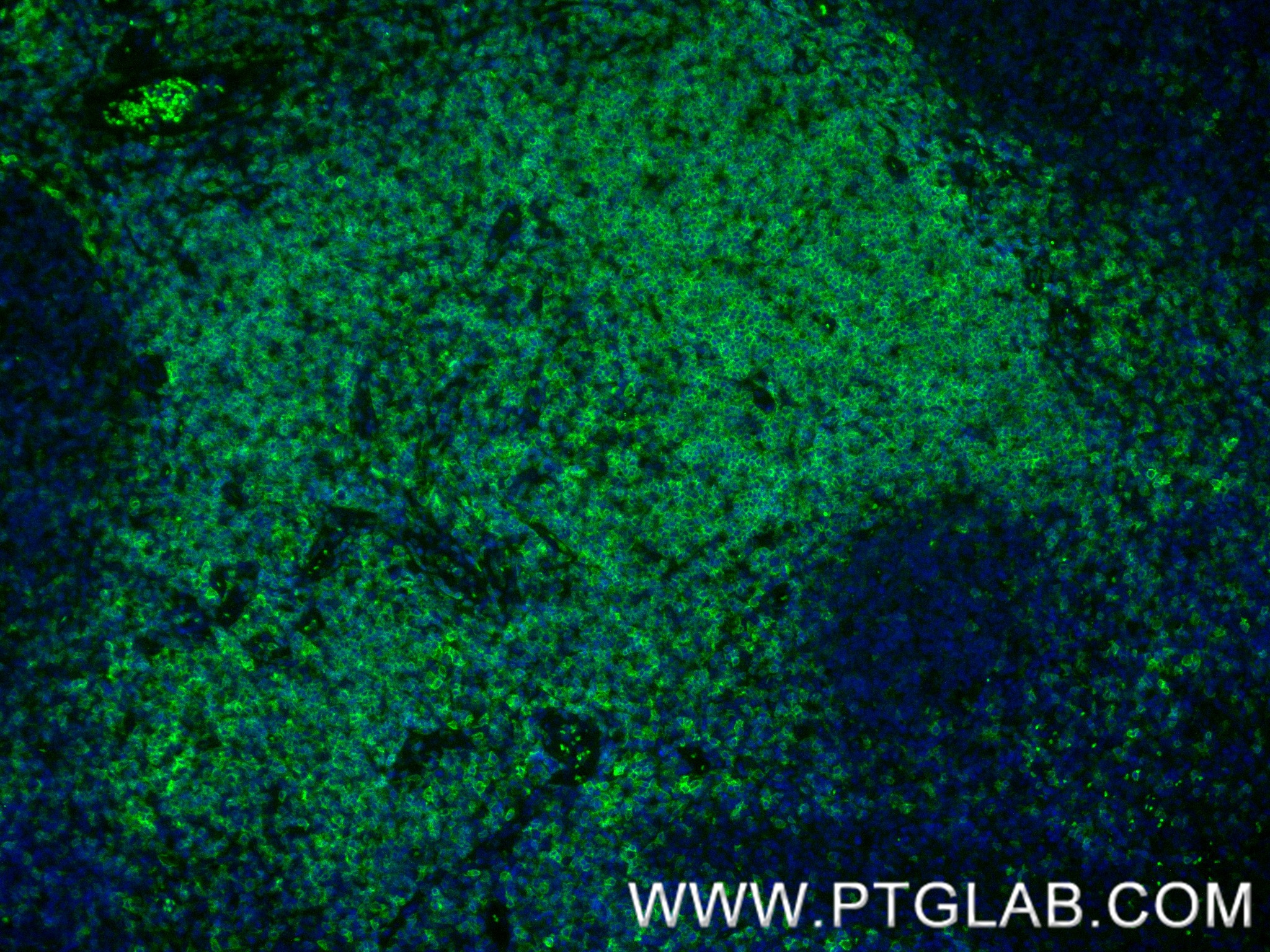 IF Staining of human tonsillitis using 85066-5-RR (same clone as 85066-5-PBS)
