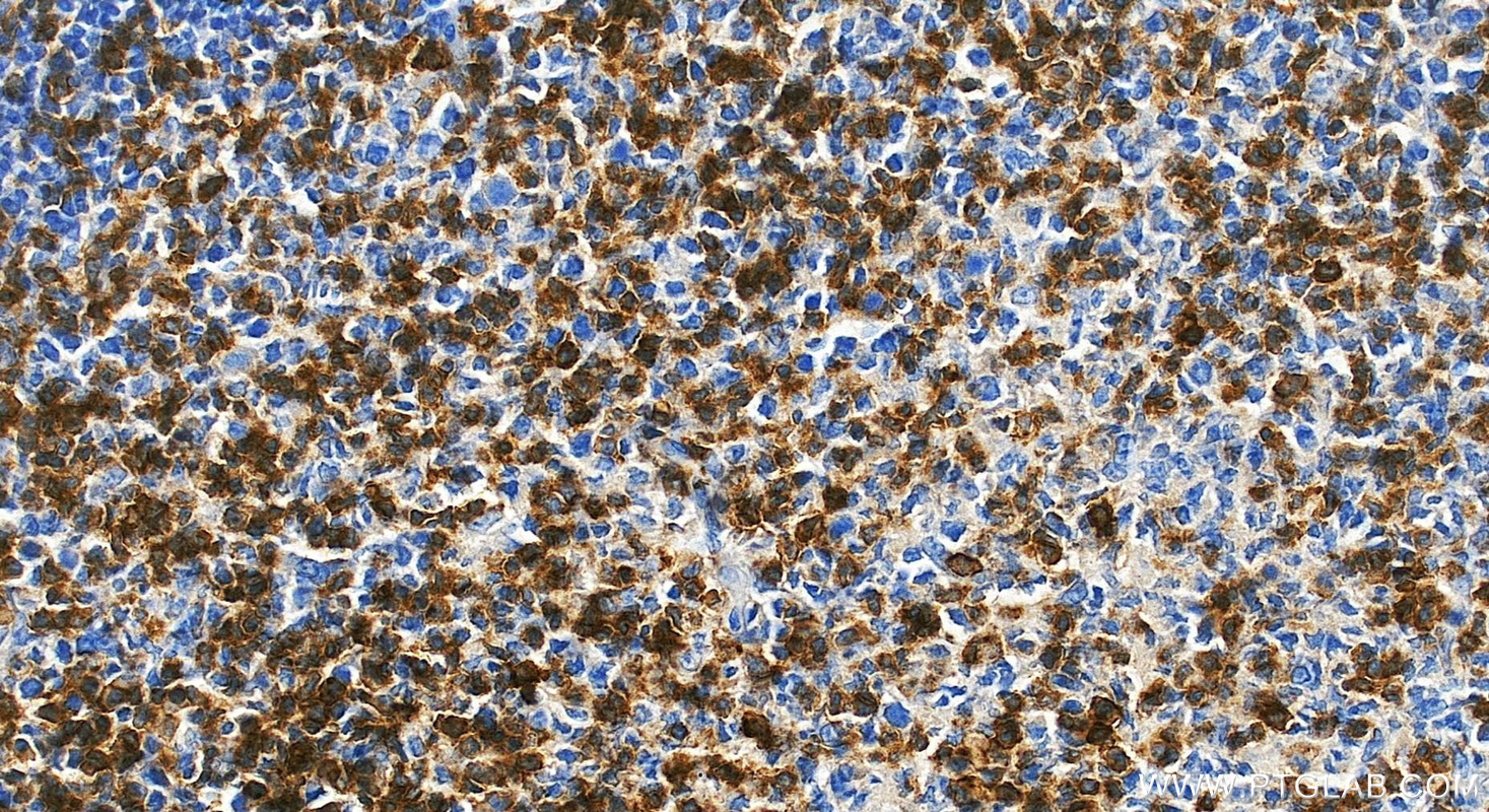 Immunohistochemical analysis of paraffin-embedded human tonsillitis tissue slide using 85066-5-RR (CD27 antibody) at dilution of 1:500 (under 20x lens). Heat mediated antigen retrieval with Tris-EDTA buffer (pH 9.0). IHC staining of human tonsillitis using 85066-5-RR