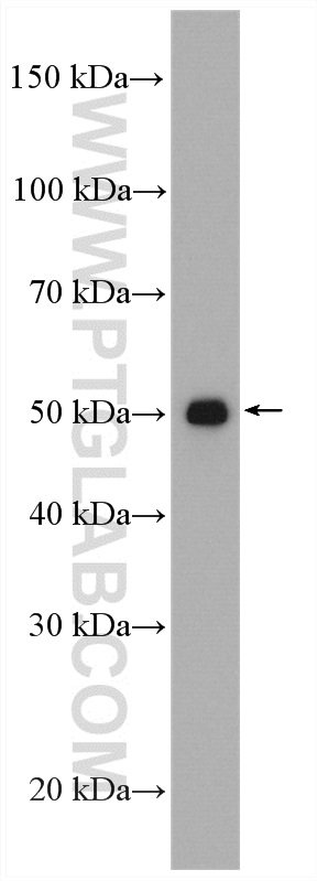 WB analysis of human placenta using 17952-1-AP