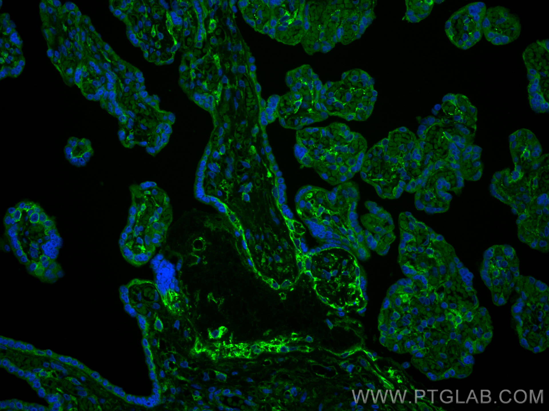 IF Staining of human placenta using 66481-1-Ig (same clone as 66481-1-PBS)