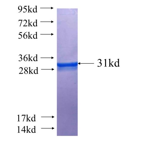 CD28 fusion protein Ag24058 SDS-PAGE