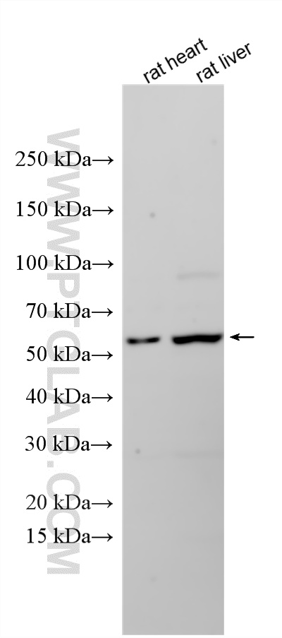 Various lysates were subjected to SDS PAGE followed by western blot with 33949-1-AP (CD297/ART4 antibody) at dilution of 1:1500 incubated at room temperature for 1.5 hours. WB analysis using 33949-1-AP