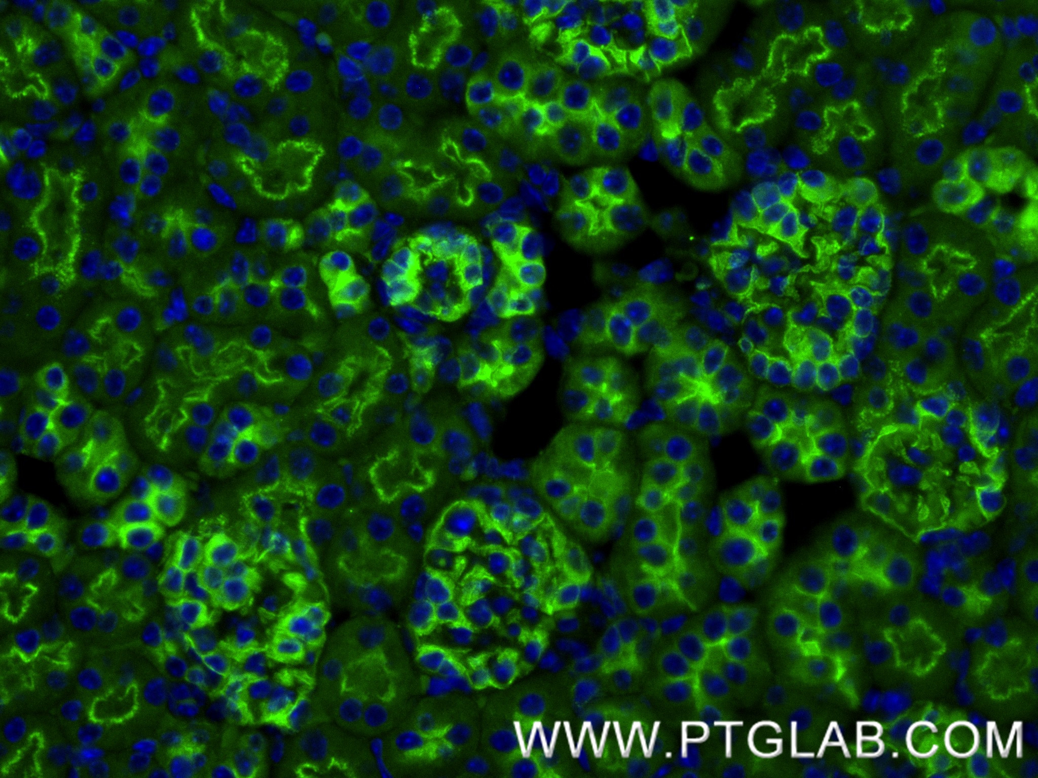 IF Staining of mouse kidney using 86727-1-RR IF Staining of mouse kidney using 86727-1-RR