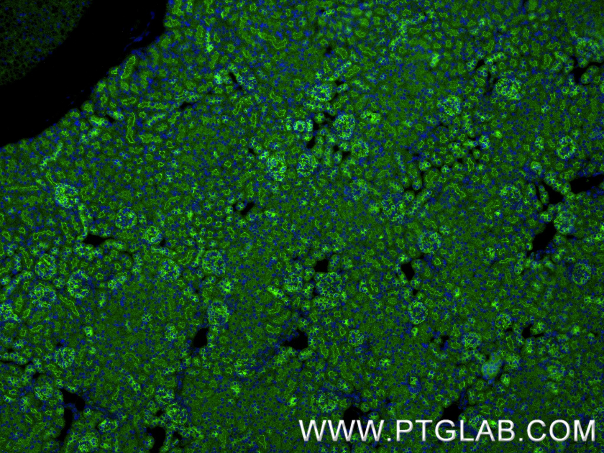 IF Staining of mouse kidney using 86727-1-RR IF Staining of mouse kidney using 86727-1-RR