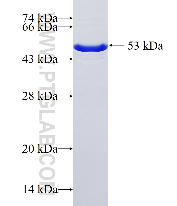 CD2AP fusion protein Ag36919 SDS-PAGE