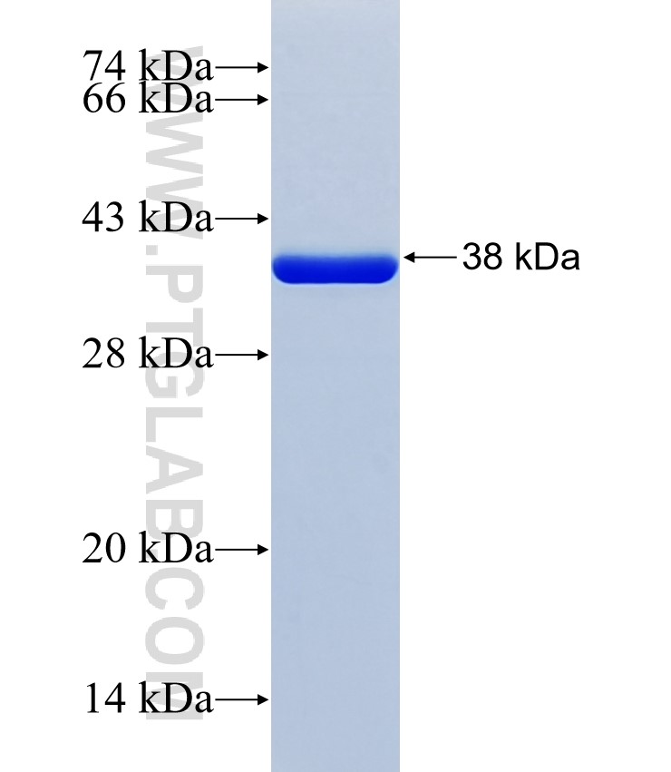 CD2BP2 fusion protein Ag38662 SDS-PAGE
