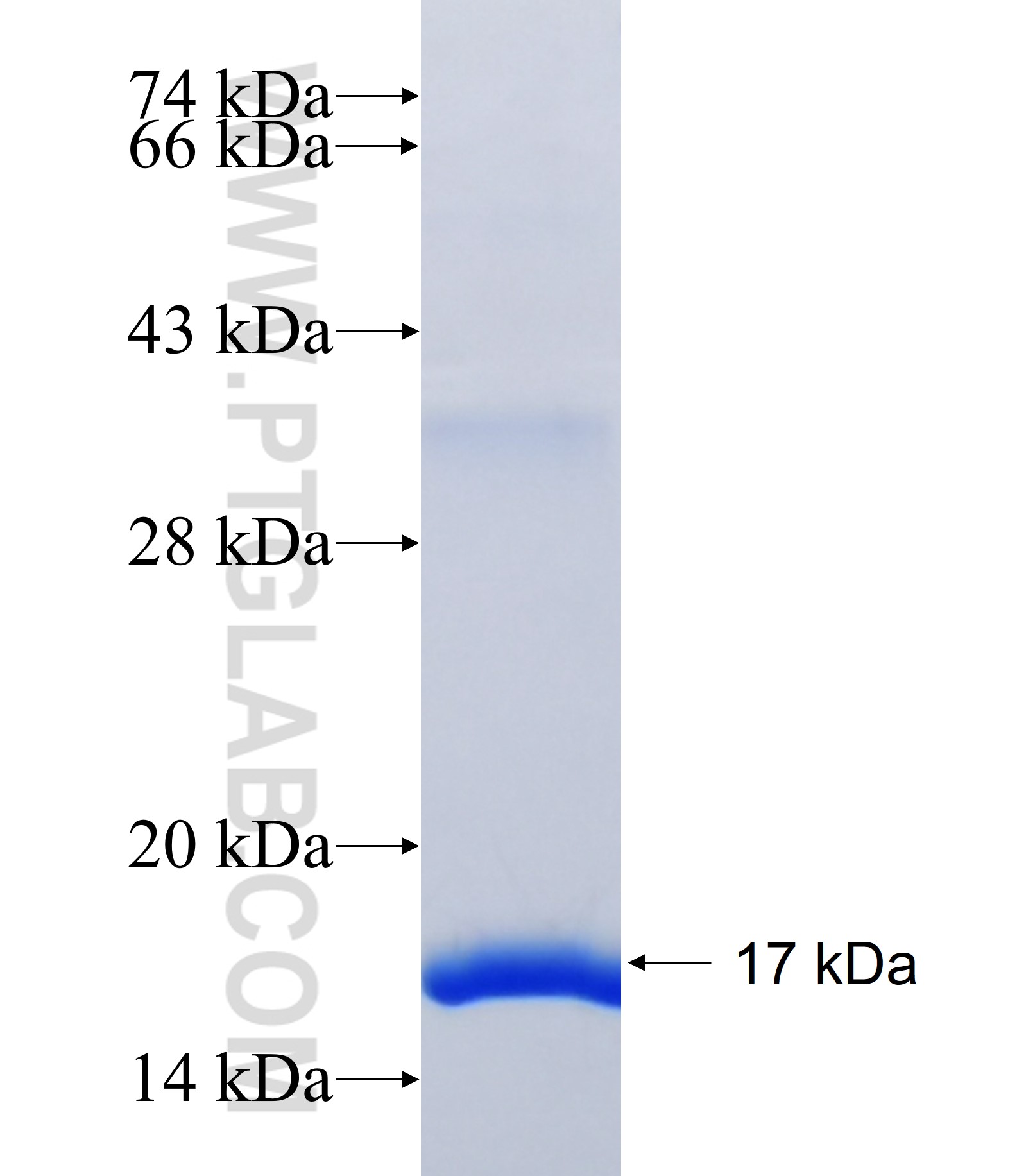CD2BP2 fusion protein Ag38673 SDS-PAGE CD2BP2 fusion protein Ag38673 SDS-PAGE