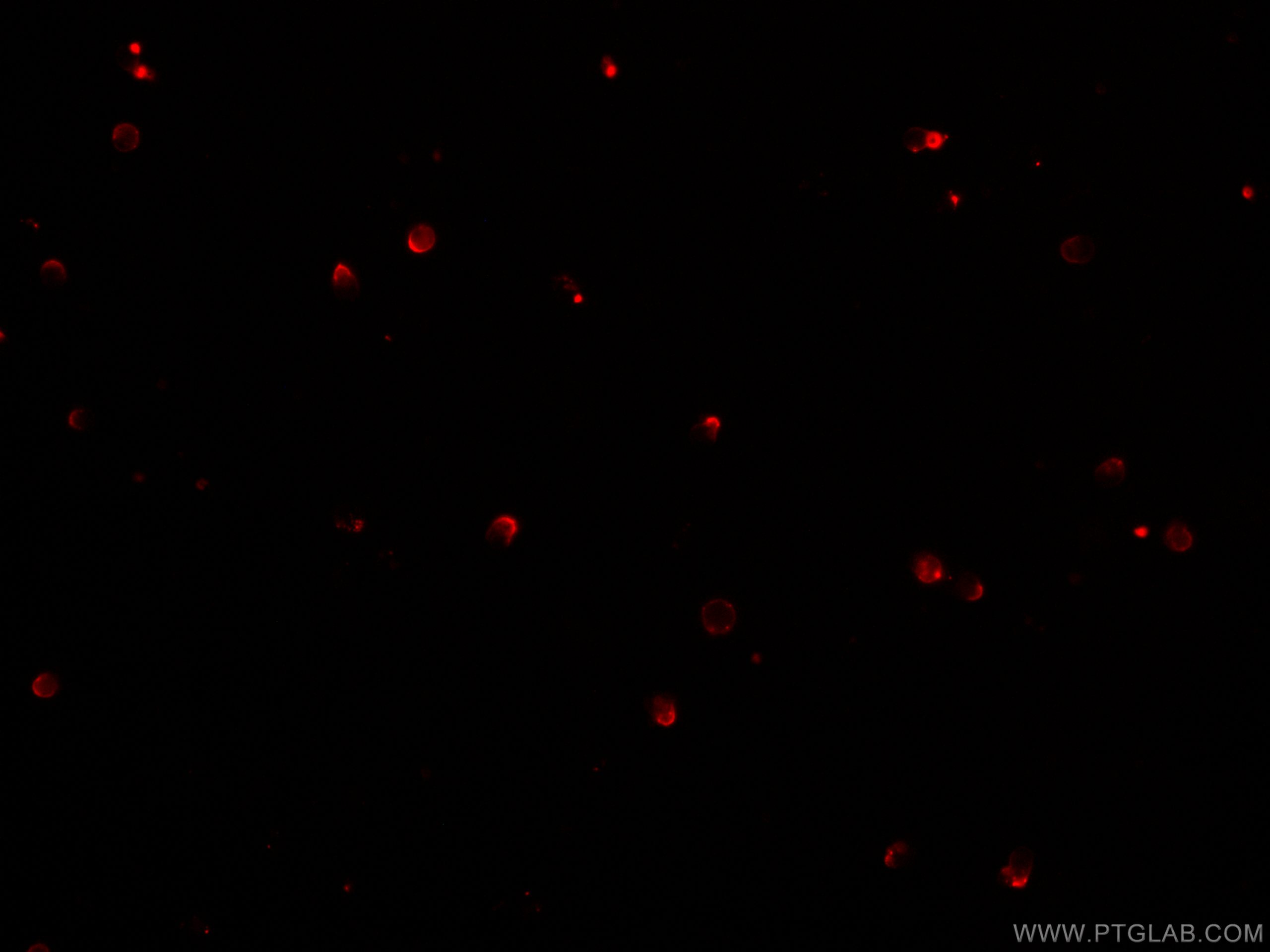 IF Staining of mouse splenocytes using CL647-65061