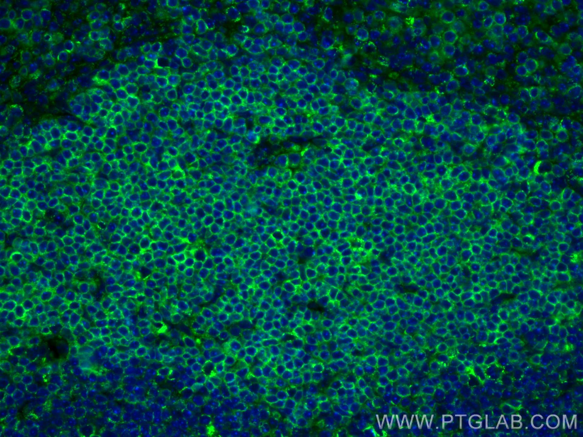 IF Staining of mouse spleen using CL488-17617